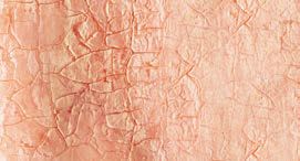 peau avant le traitement - Laboratoire Naturoscience